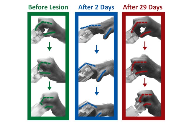 Two days after lesion, monkeys perform poorly compared to before the injury. Twenty-nine days after injury performance was greatly improved and resembled that from before injury. Credit: RIKEN.