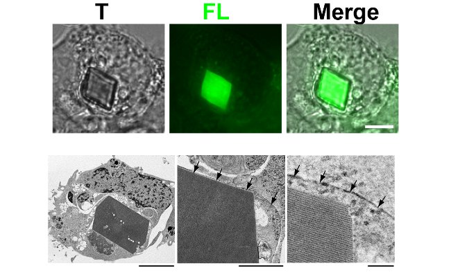 Top row: A giant fluorescent green Xpa crystal seen within a cell under light microscopy. Bottom row: An electron microscopy image of a crystal within a cell. The middle and right panels show the crystal at higher magnification with arrows pointing to the lysosomal membrane covering the crystal. Credit: RIKEN.