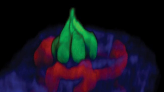 A taste bud showing receptor cells (green) blood cells (red) and collagen surrounding the bud (blue). Credit: ANU.