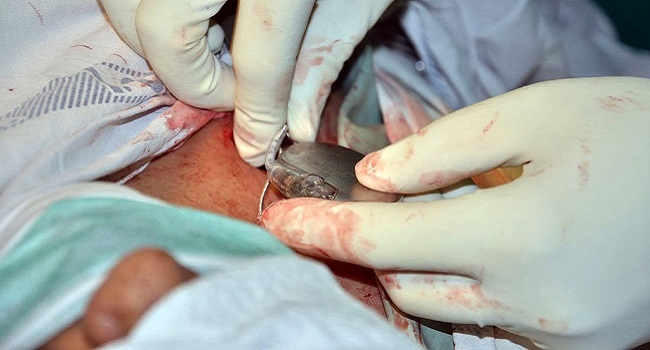 Photo: Sadasiv Swain/Flickr/CC.