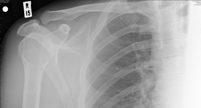 Photo: Adrian Barnes/Flickr/CC.