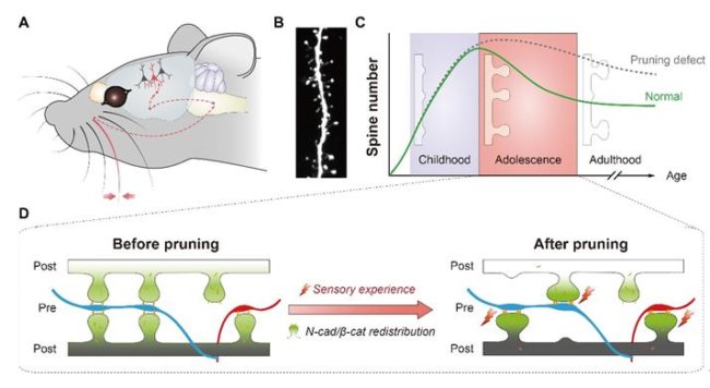 A mouse model of spine pruning. Credit: Yu Xiang/CAS.