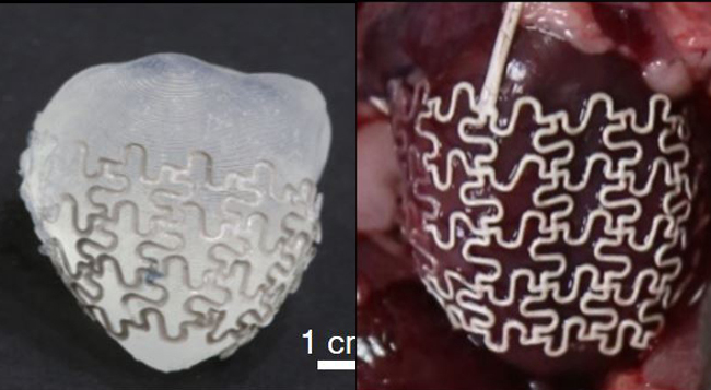 Left: the epicardial mesh encircling a 3D-printed rat heart model. Right: the epicardial mesh implanted in a control rat heart. Credit: Park et al., Science Translational Medicine  (2016)