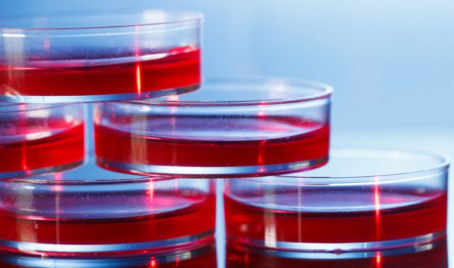 Sorrento, CHA Biotech To Develop Natural Killer Cell Therapies