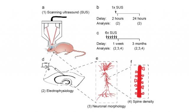 Ultrasound Slows Brain Aging In Mice