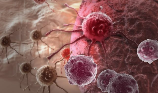 How To Control The Spread Of Breast Cancer Cells