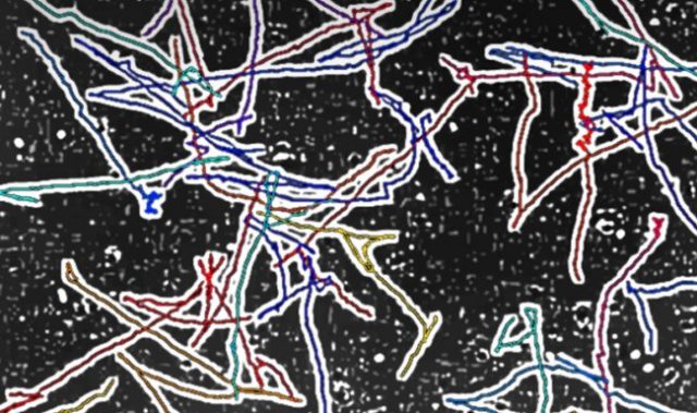 MapZ Is The Bacteria’s ‘Rudder’
