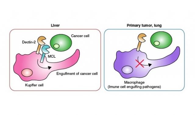 Kupffer Cells Guard The Liver Against Metastatic Cancer