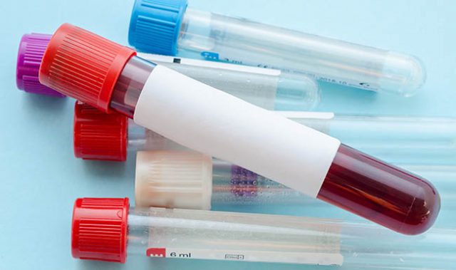 Daily Platelet Counts Predict Kids’ Risk Of Dengue Shock Syndrome