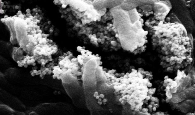 Magnets Turn Viruses Into Bacteria-Killers