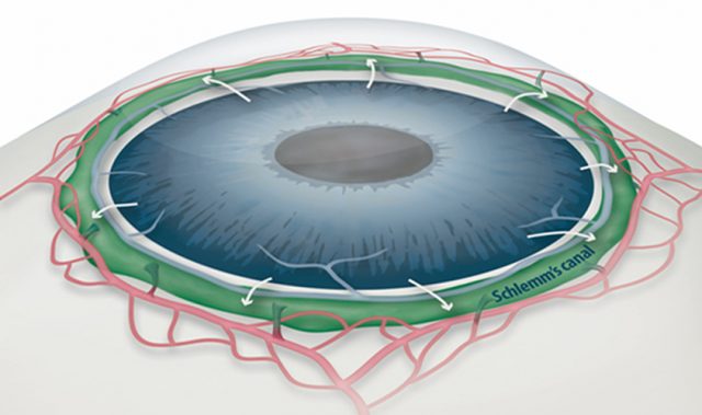 Preventing Glaucoma By Unclogging The Eye’s ‘Drainage Canals’