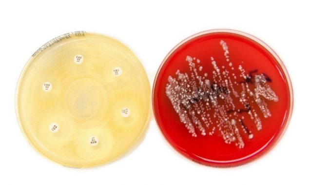 Shedding Light On Bacterial Infections