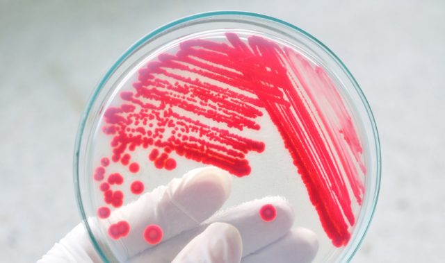 Antibiotic-Resistant Bacteria Widespread In China