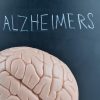 Mutations That Protect Against Alzheimer’s Disease