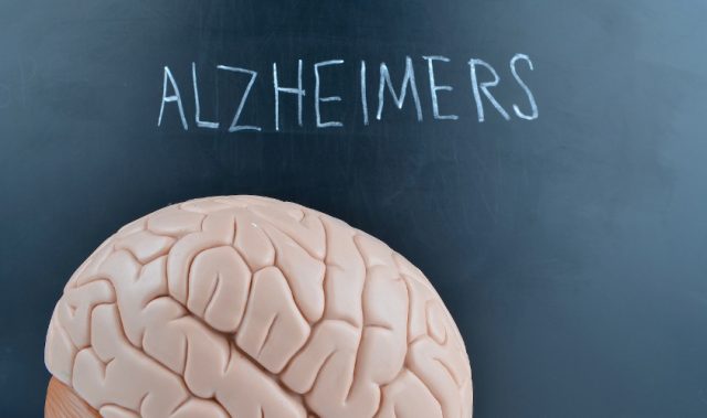 Mutations That Protect Against Alzheimer’s Disease