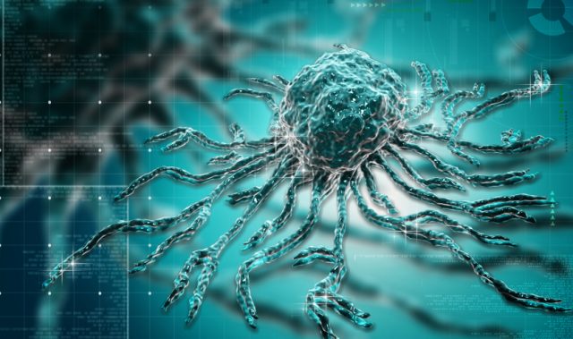 AI Automatically Sorts Cancer Cells