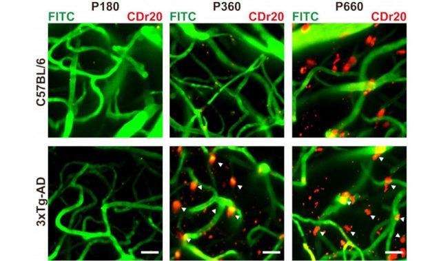 Watching Brain Immune Cells In Action