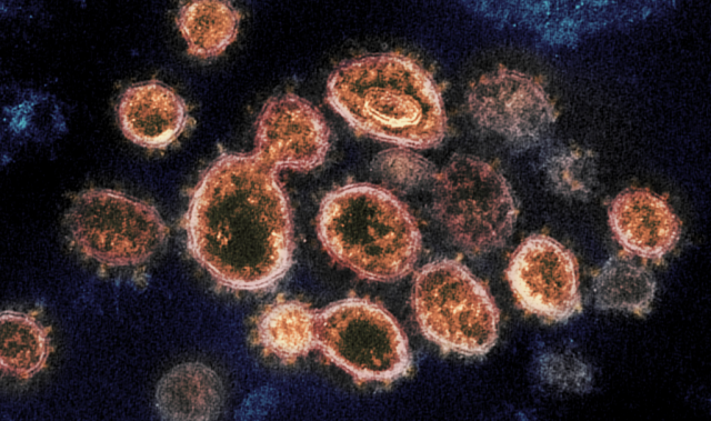 Mutation Making SARS-CoV-2 Milder Identified