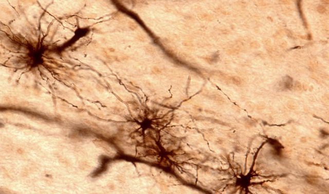 Astrocytes: More Than Just A Neuron’s Assistants