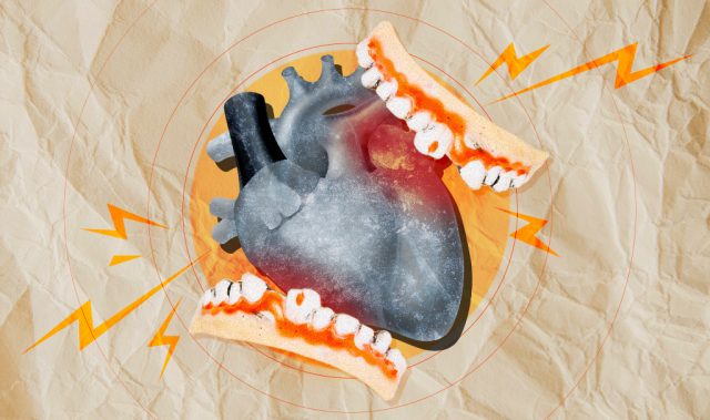 Poor Oral Health May Harm Your Heart