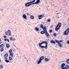 Scientists Identify Protein That Contributes To Fibrosis