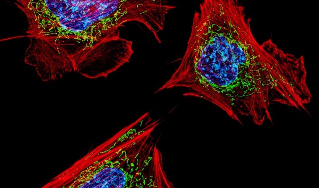 A Big Feat: Scientists Have Turned Skin Cells Into Limb Cells