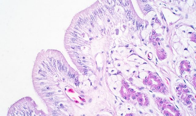 How Gut Cells Chat Like Neurons